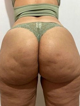 Soraya Culona